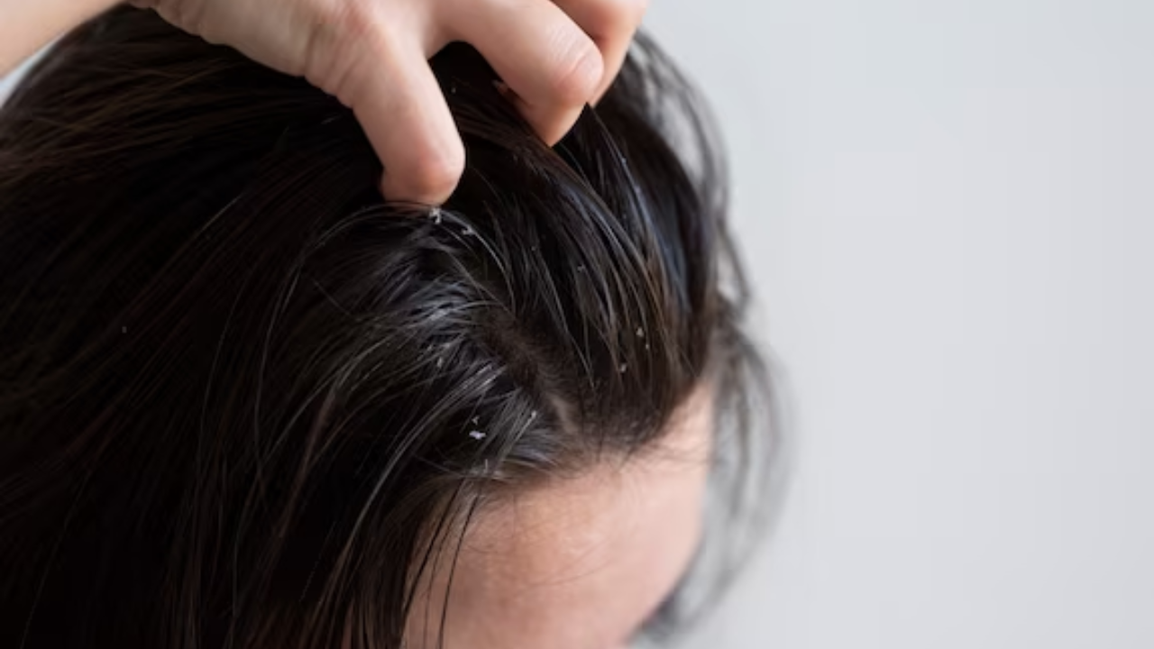 Tips On How To Revitalize Your Scalp
