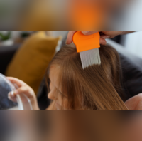 3 Indian home remedies to remove lice and their eggs from the hair