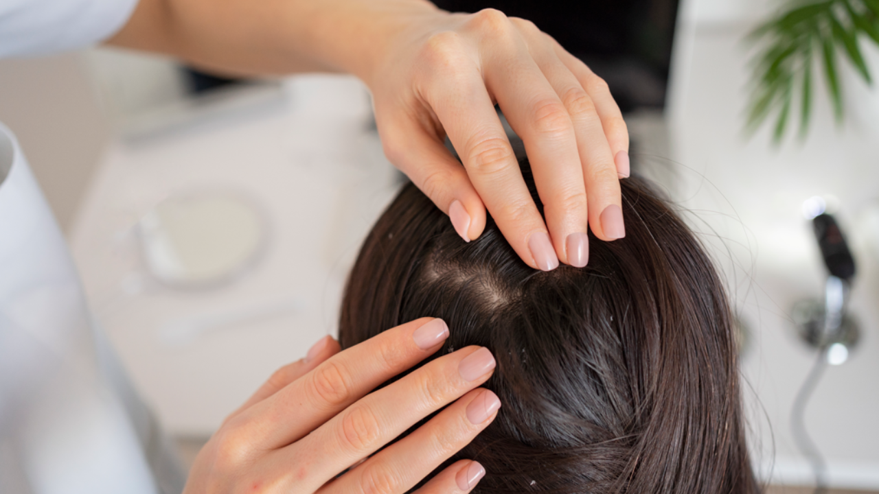 Follow these healthy haircare tips to take care of dry and oily scalp