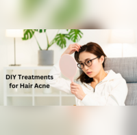 Acne on Scalp Get rid of pesky hair acne with these simple and