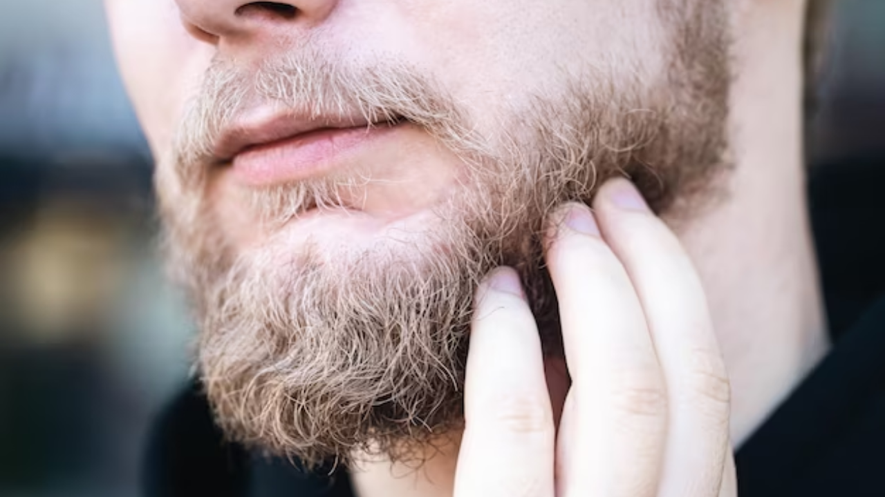 how-to-get-rid-of-beard-related-pimples-proactiv