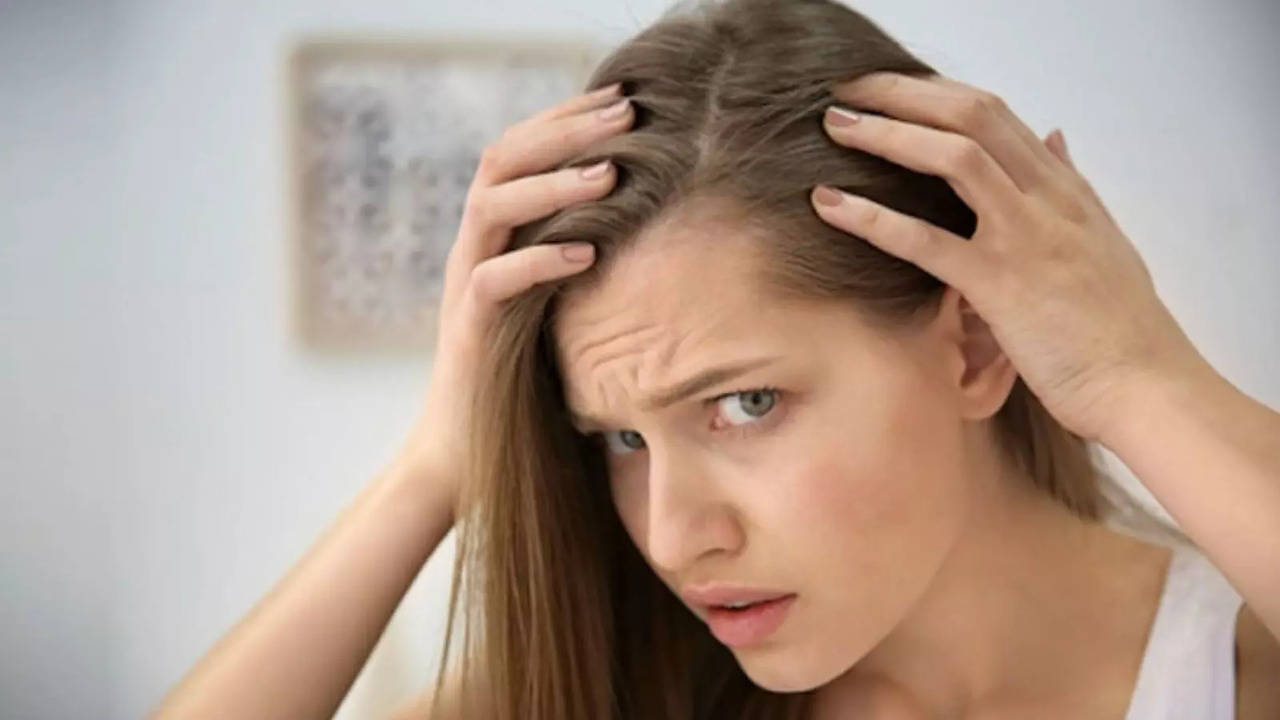 Balanced Diet To Stress Management: 10 Simple Tips To Get Rid Of Dandruff