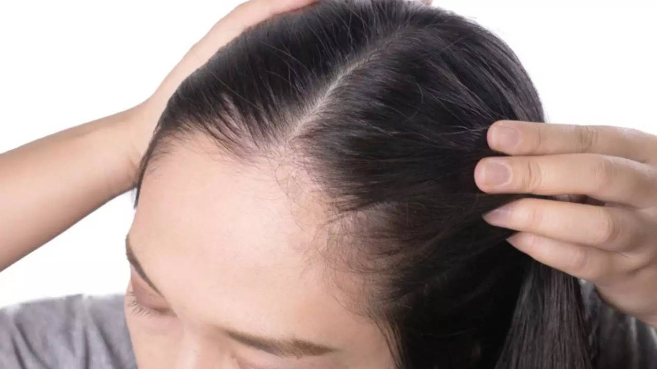 Understanding Scalp Acne: Its Causes And  Possible Treatments