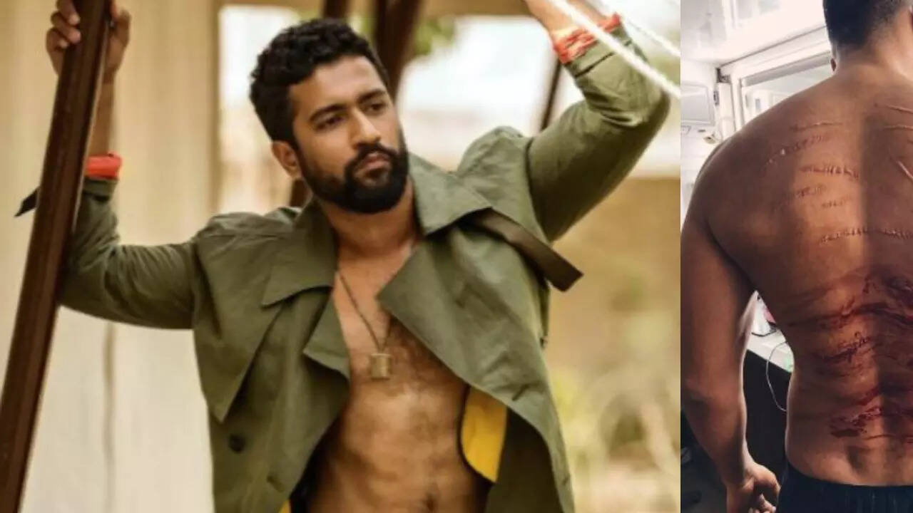 Vicky Kaushal’s Bloodied And Bruised Back Will Shock You, But There’s A ...