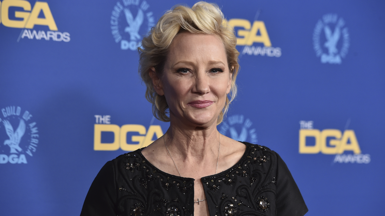 Actress Anne Heche in critical condition after suffering severe burns ...