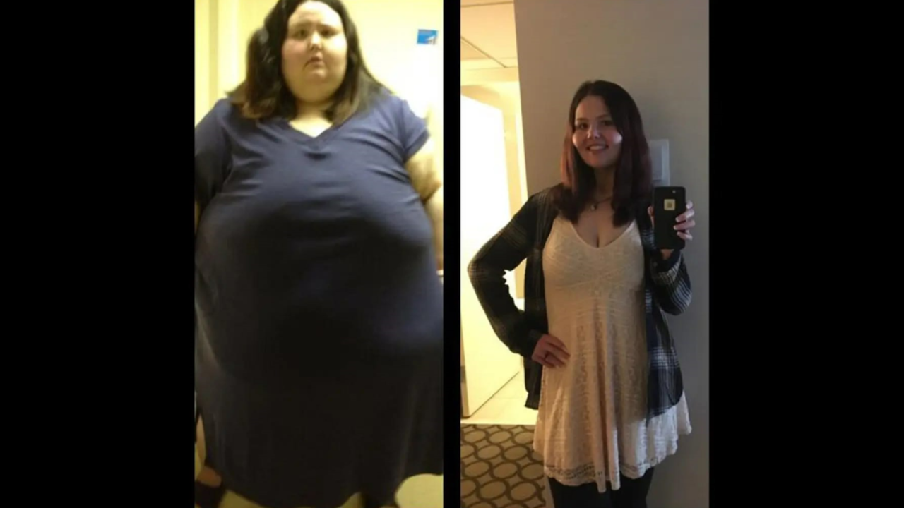 Weight Loss: 32-year-old woman sheds 226 kg in a massive weight loss transformation