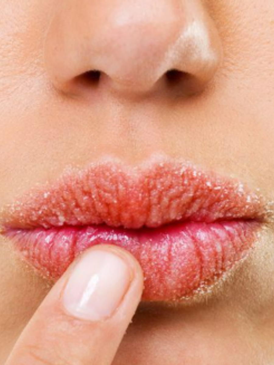 dry-lips-home-remedy-try-these-simple-ingredients-to-treat-dry-lips-at-home-zoom-tv