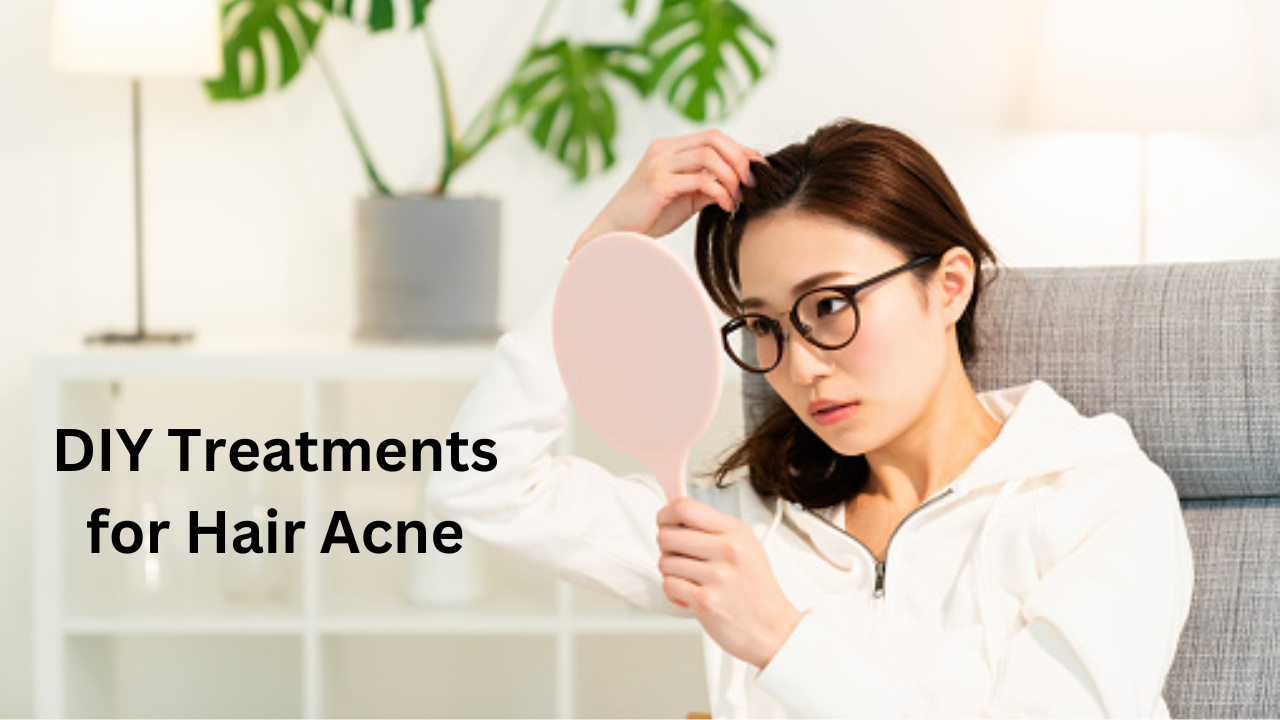 Acne on Scalp Get rid of pesky hair acne with these simple and